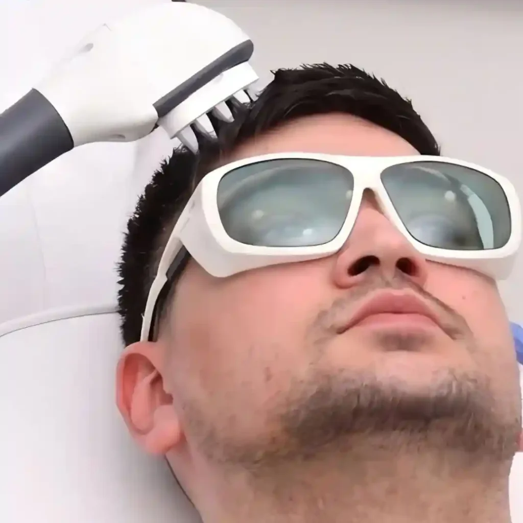 Hair Restart laser za kosu poliklinika Diva dr Bogdanović