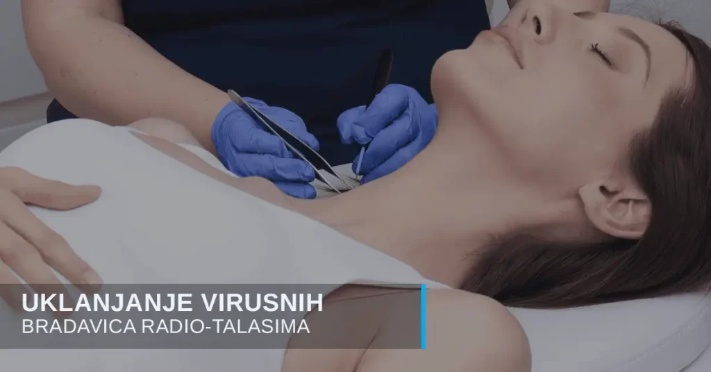 Moluske - virusne bradavice