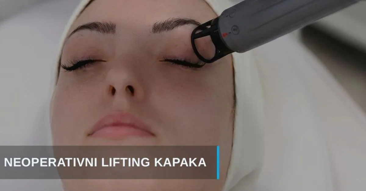Neoperativno zatezanje kapaka