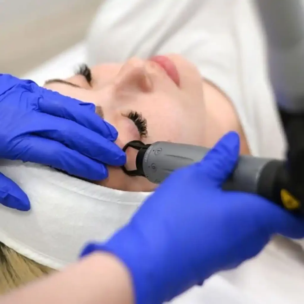 Podizanje kapaka Nano Q laserskim liftingom poliklinika Diva