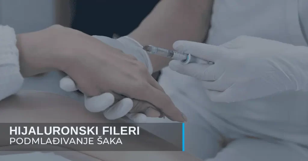 Podmlađivanje šaka - kako da koža ruku bude mlađa za čitavu deceniju - poliklinika Diva