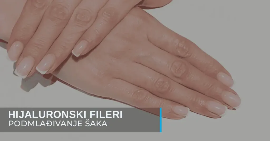 Podmlađivanje šaka - kako da koža ruku bude mlađa za čitavu deceniju - poliklinika Diva