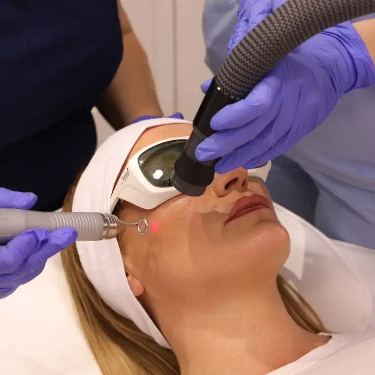 4D Combo podmlađivanje laserom - oporavak - poliklinika Diva Beograd