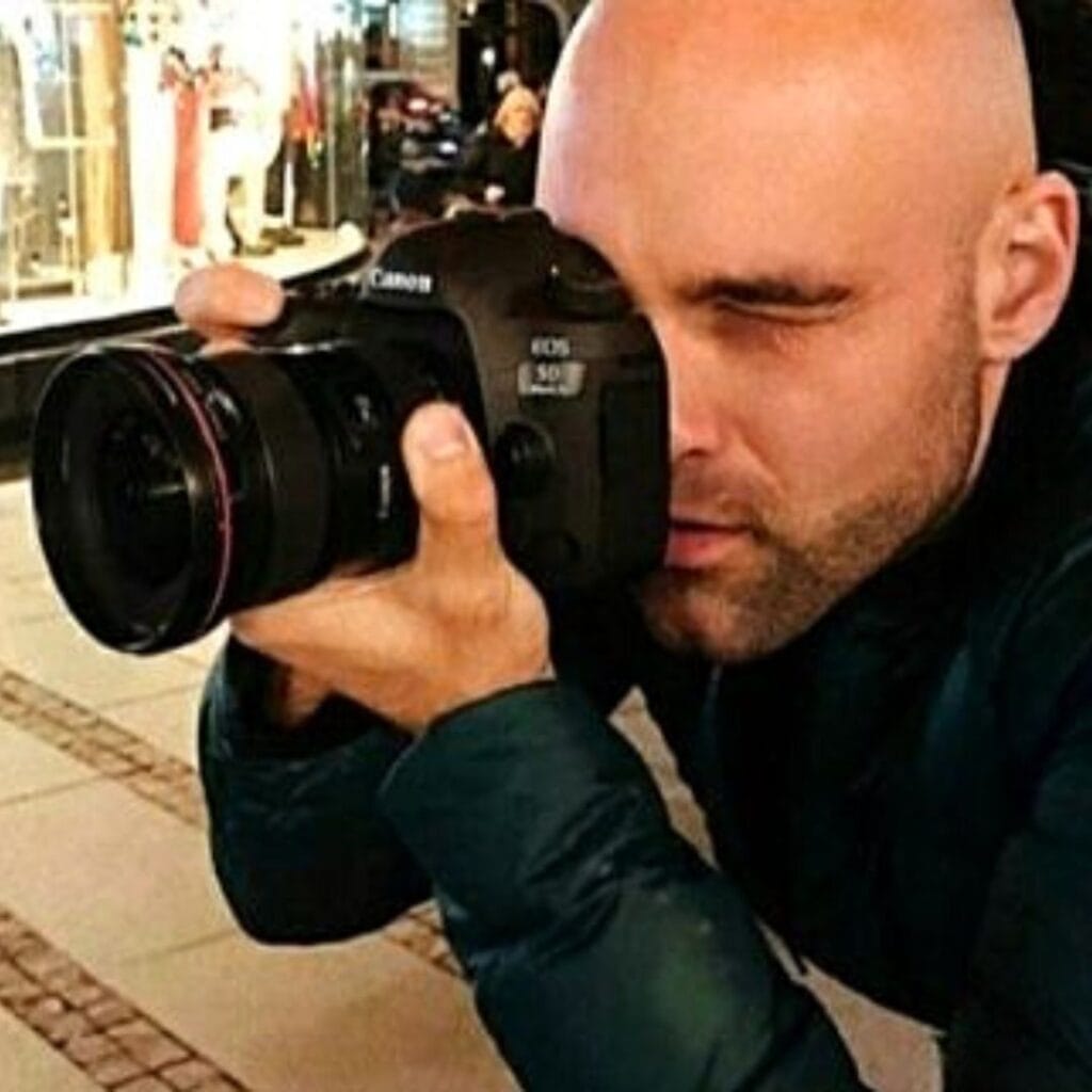 hijaluronski fileri iskustva pacijenata