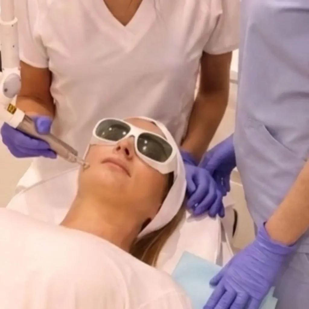Lasersko podmlađivanje u poliklinici Diva