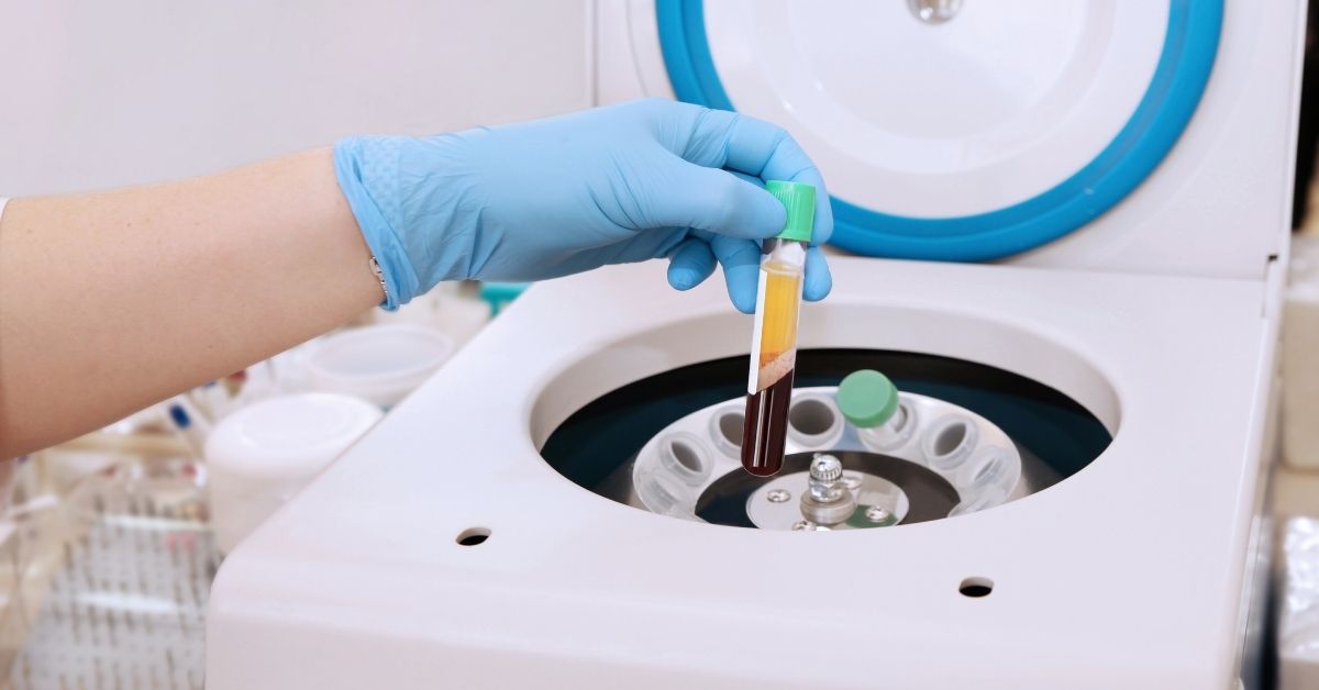 centrifugiranje-krvne-plazme-poliklinika-diva-dr-bogdanovic