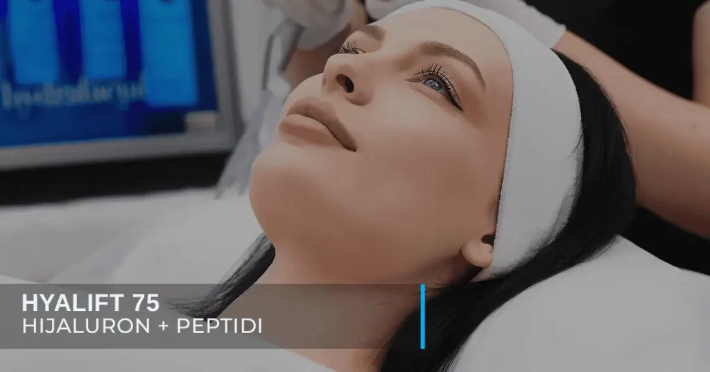 Hyalift 75 mezoterapijski skinbooster