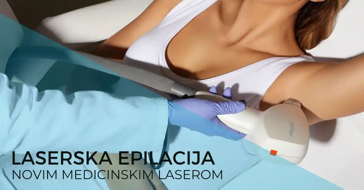 laserska-epilacija-poliklinika-diva-dr-bogdanovic