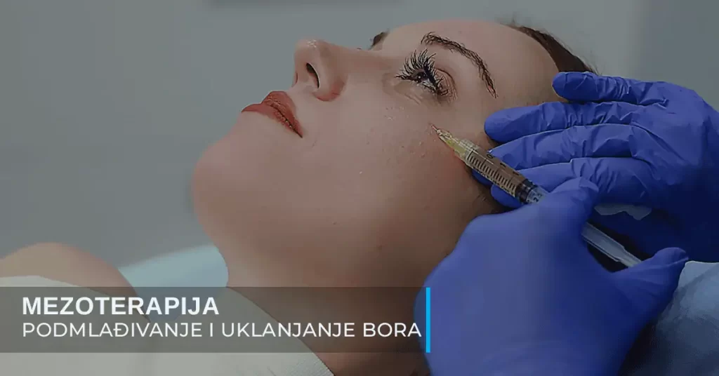 Mezoterapija lica