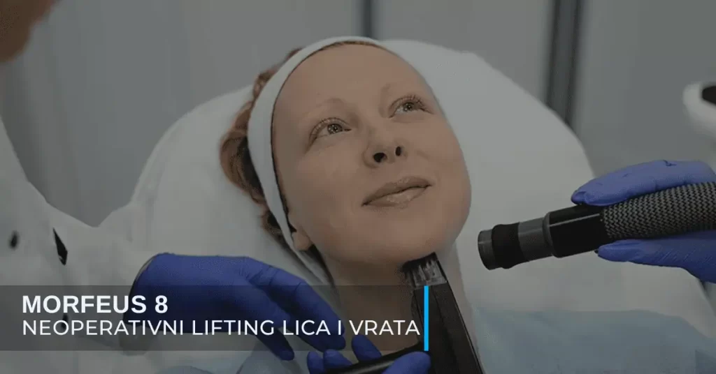 Nehirurški lifting lica neoperativnim Morfeus 8 aparatom