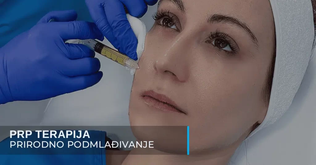 PRP tretman u poliklinici Diva