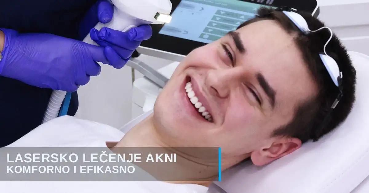 Uklanjanje akni laserom Diva poliklinika