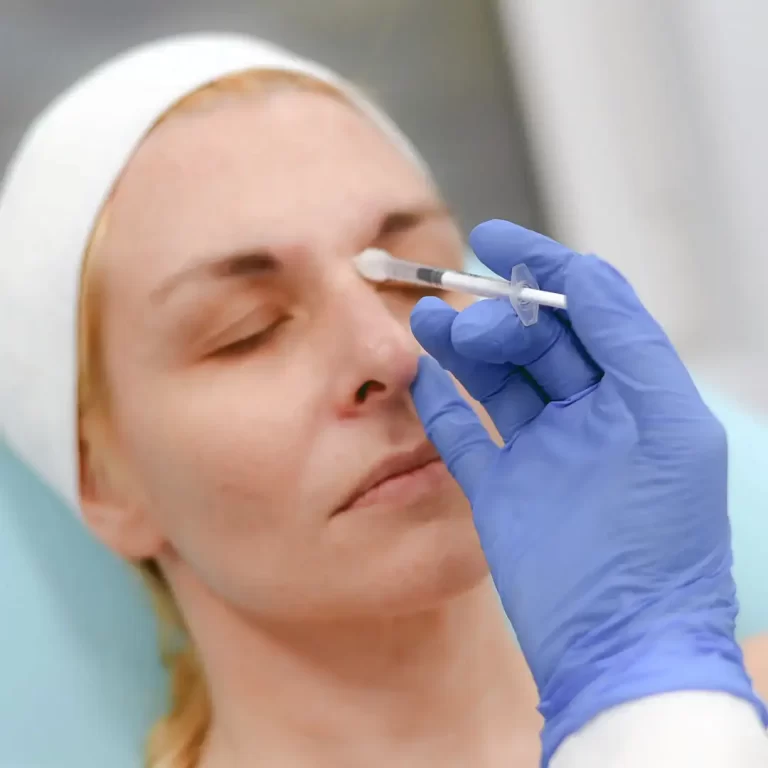 Uklanjanje bora podmlađivanje poliklinika Diva dr Bogdanović