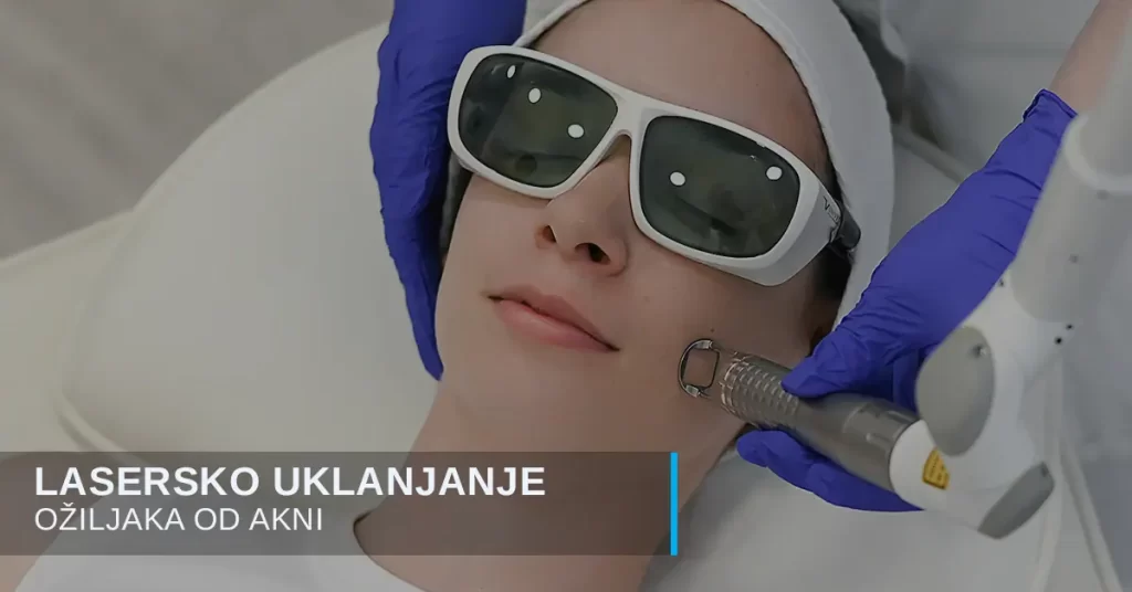 Uklanjanje ožiljaka od akni