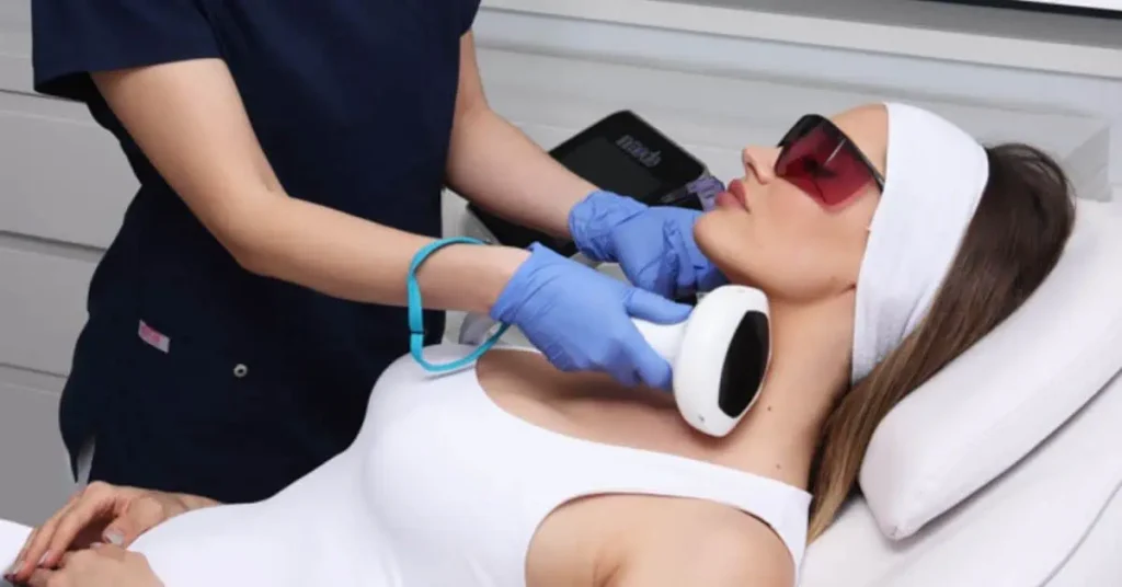 Dermatološki laseri poliklinika Diva