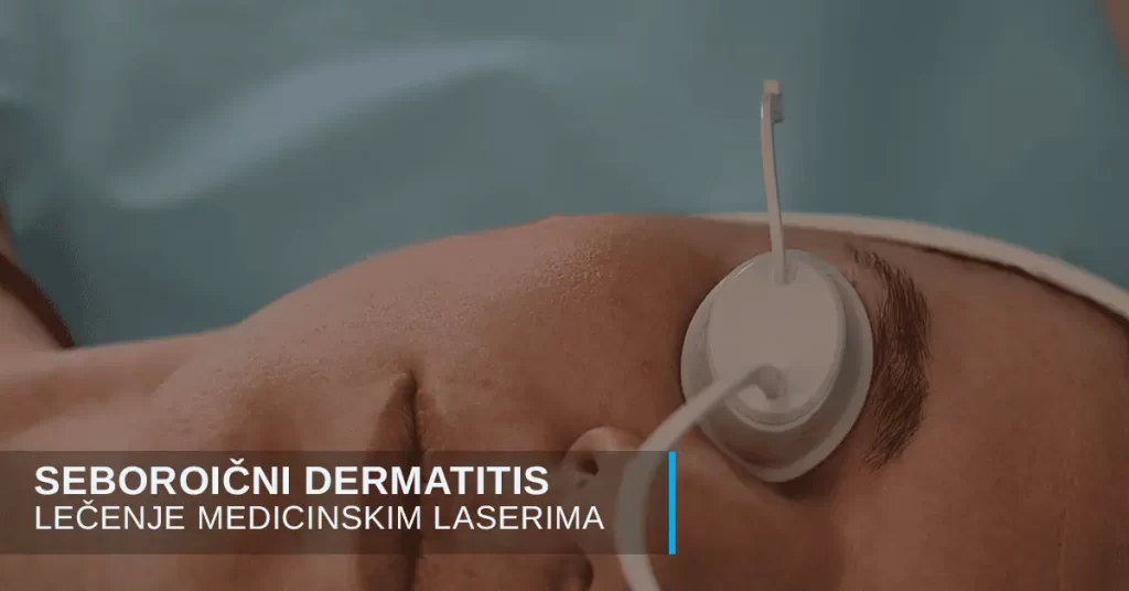 Seboroični dermatitis lečenje laserom