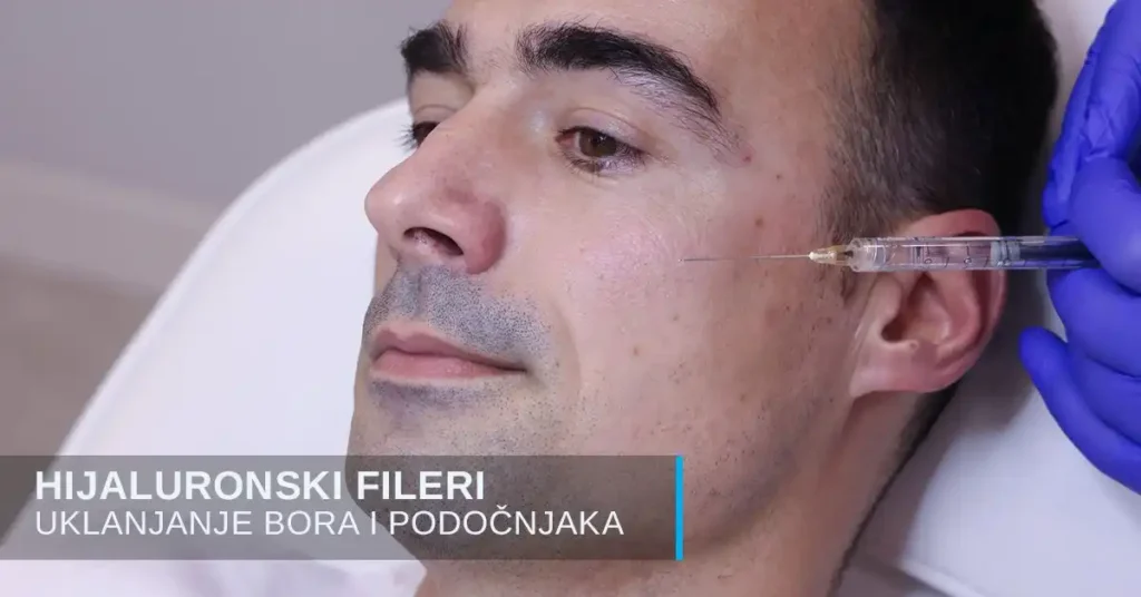 Hijaluron za muškarce