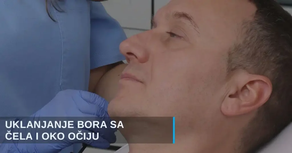 Uklanjanje bora procedura za muškarce poliklinika Diva dr Bogdanović