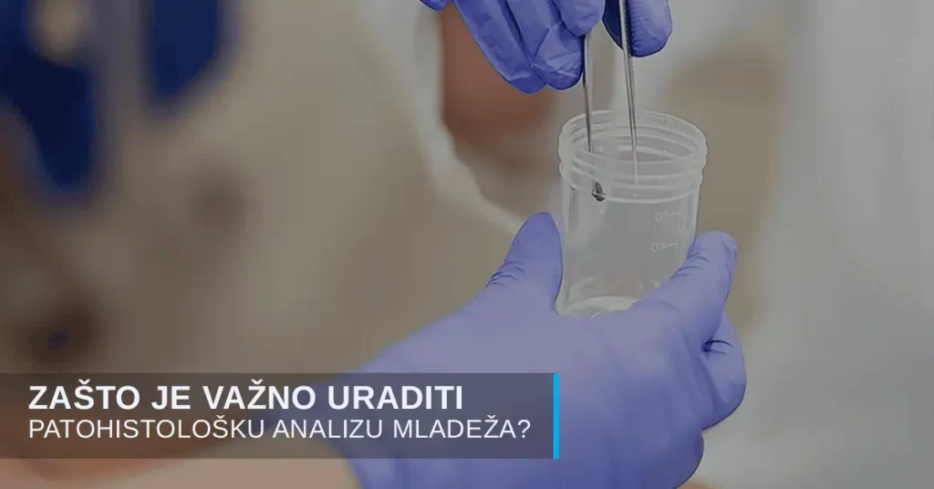 Zašto je važno uraditi patohistološku analizu nakon uklanjanja mladeža?