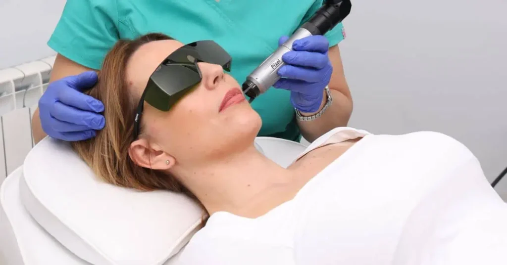 Šta sve može laser za leti Poliklinika Diva dr Bogdanović dermatologija