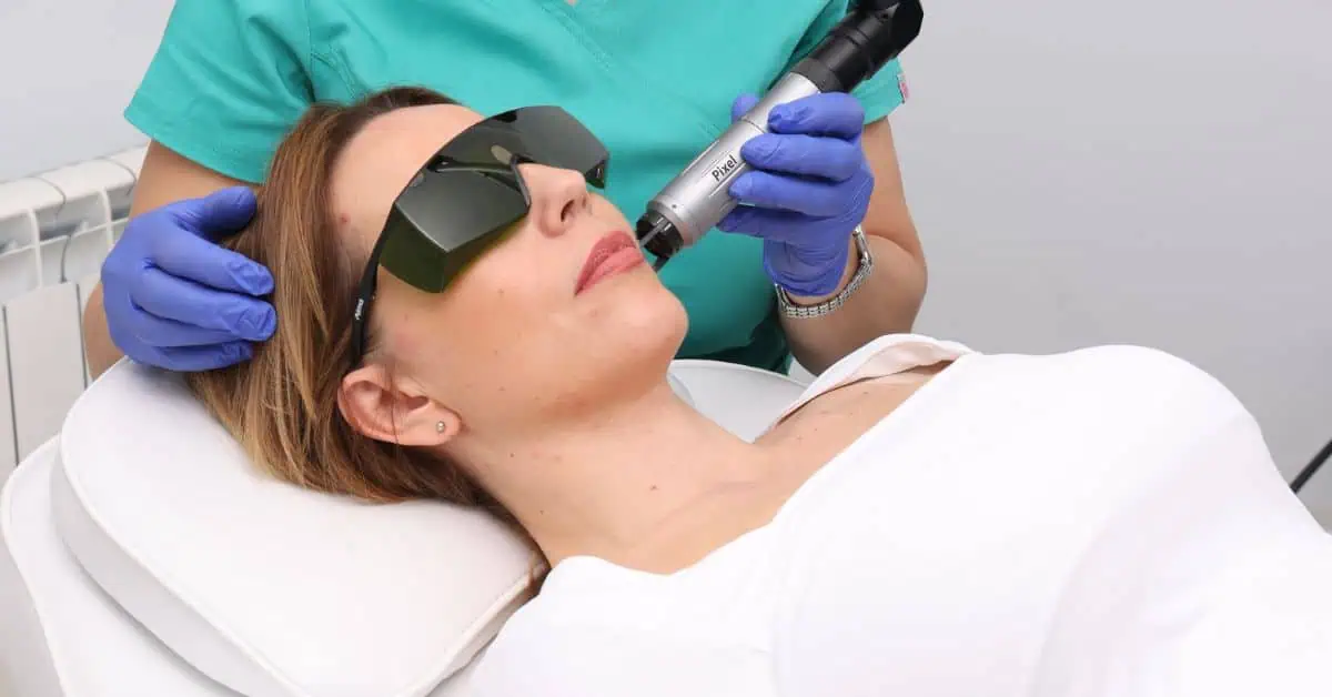 Šta sve može laser za leti Poliklinika Diva dr Bogdanović dermatologija