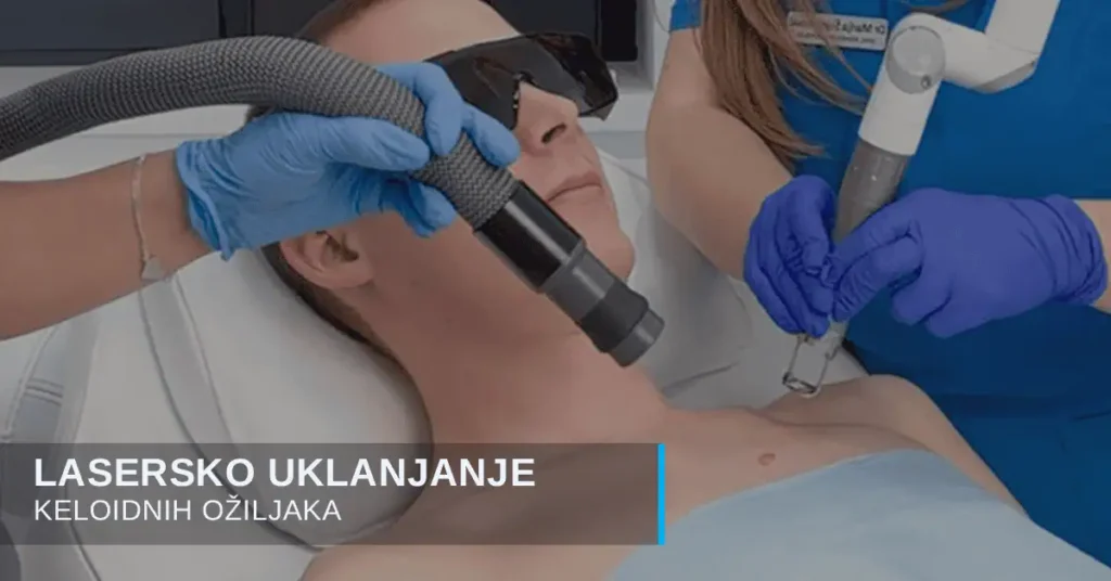 Keloidni ožiljci