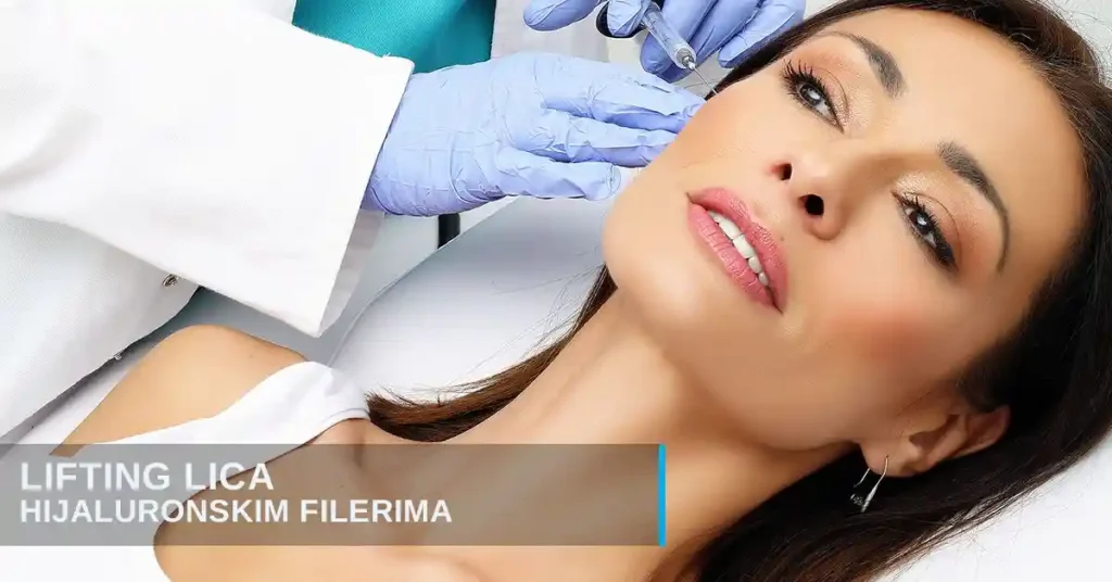 Lifting lica hijaluronom u poliklinici Diva dr Bogdanović