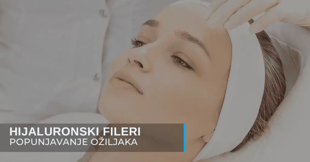 Popunjavanje ožiljaka hijaluronom poliklinika Diva dr Bogdanović