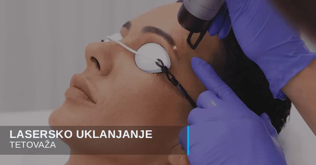 Lasersko uklanjanje tetovaža i obrva