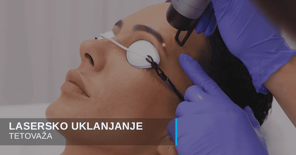 Lasersko uklanjanje tetovaža i obrva
