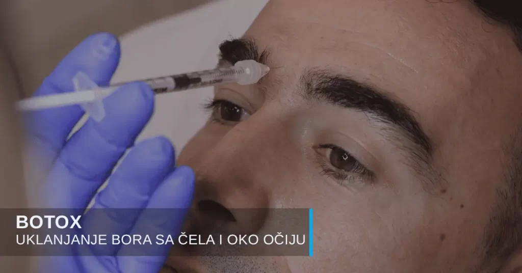 Botoks za uklanjanje bora kod muškaraca