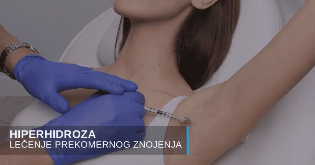 Hiperhidroza - preterano znojenje