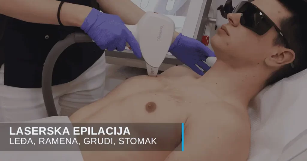 Laserska epilacija za muškarce