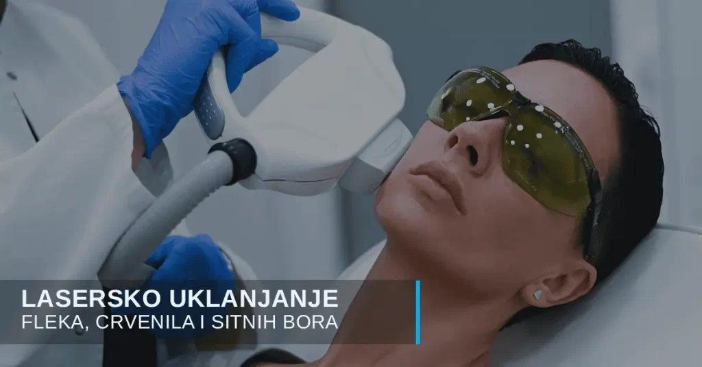 Laserska terapija za lep ten
