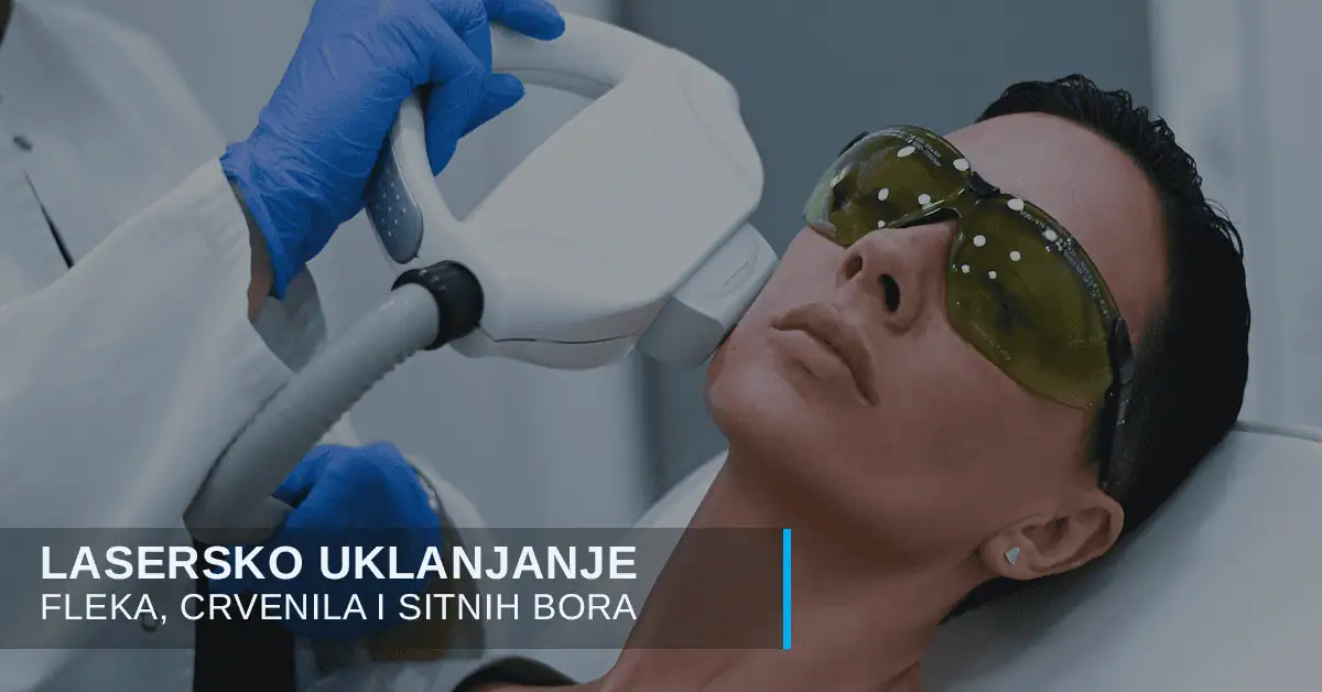 Laserska terapija za lep ten