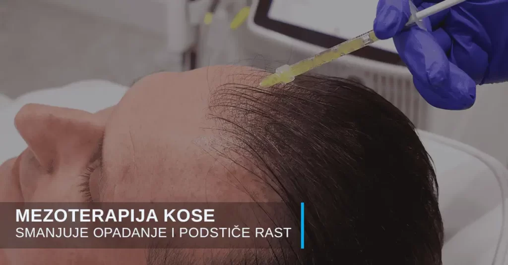 Mezoterapija kose