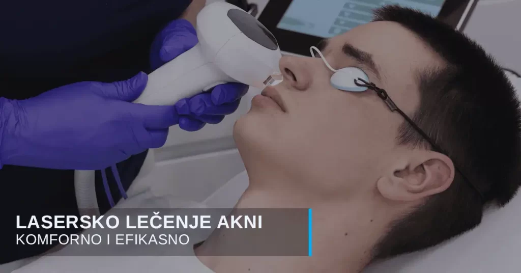 Uklanjanje akni laserom