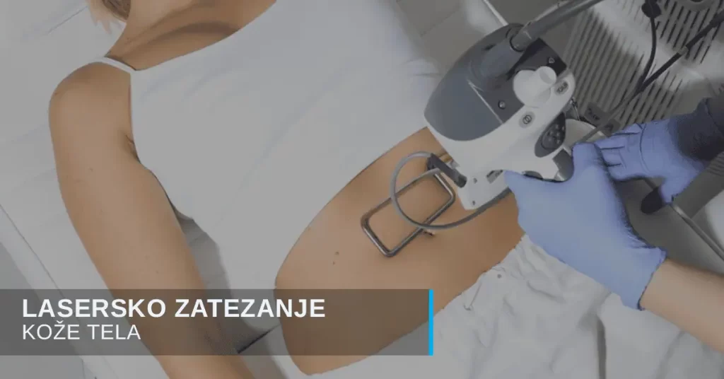 Zatezanje kože tela laserom
