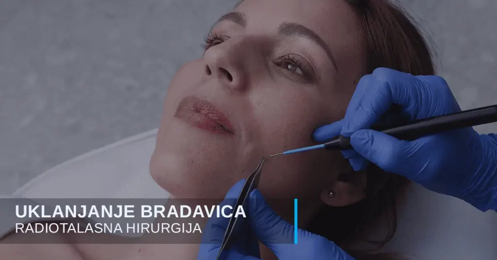 Radiotalasna hirurgija u poliklinici Diva