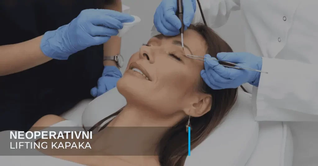 Neoperativno zatezanje kapaka