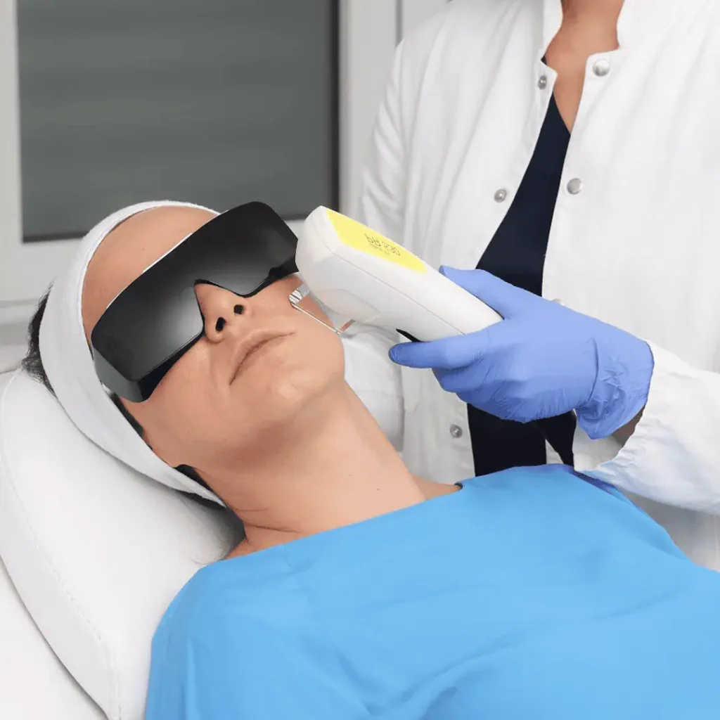 Nordlys IPL laserska tehnologija poliklinika Diva