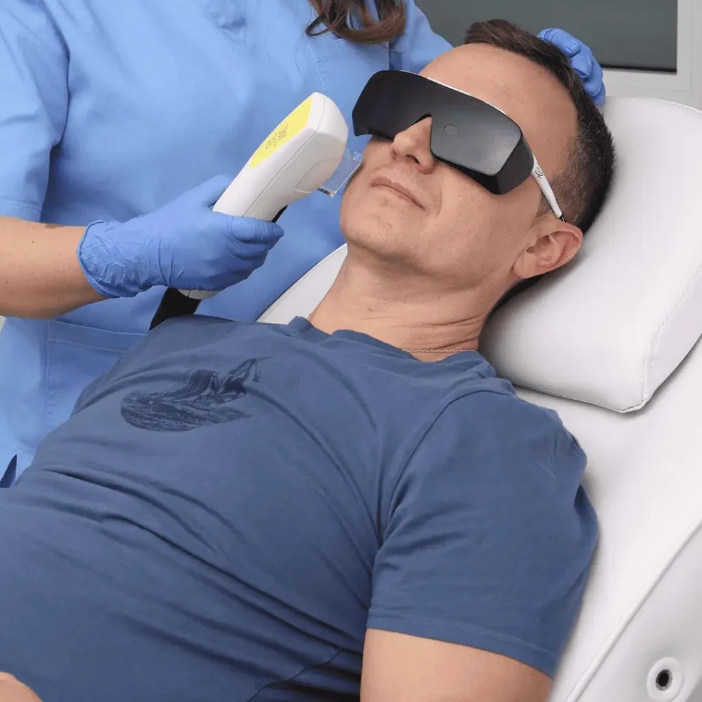 Nordlys lasersko podmlađivanje poliklinika Diva