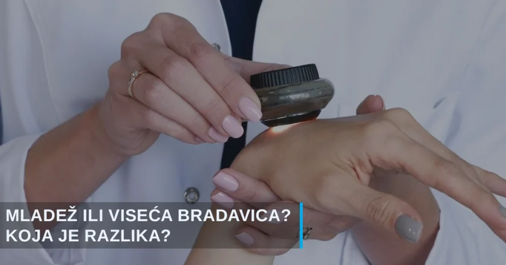 Mladež ili viseća bradavica pregled lekara specijaliste